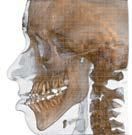 Vista laterale di un cranio umano che mostra la struttura ossea, i denti e le vertebre cervicali in una ricostruzione 3D ottenuta tramite scansione medica.