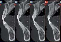 radiografia di un arto