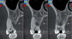 immagine radiografica ad alta risoluzione