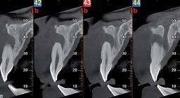 immagine radiografica