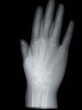 immagine radiografica mano