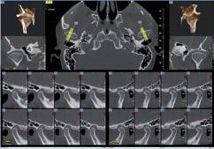 radiografia ortopedica