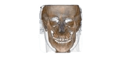 Ricostruzione medica 3D di un cranio umano che mostra la struttura ossea e i denti da una prospettiva frontale.