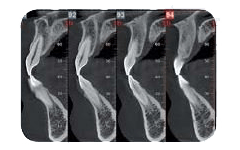 immagine radiografica del parodonto