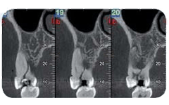 studio in d del parodonto