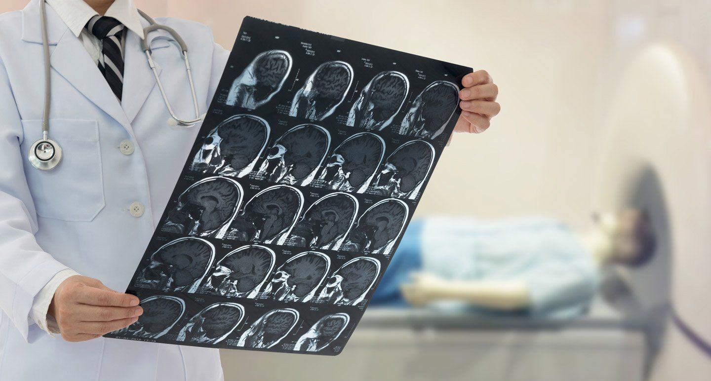 Un operatore sanitario tiene in mano una pellicola per risonanza magnetica cerebrale, mentre sullo sfondo si vede un paziente sdraiato in una macchina per la risonanza magnetica.