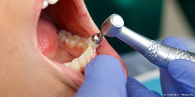 Professionelle Medizinische Zahnreinigung in der Praxis