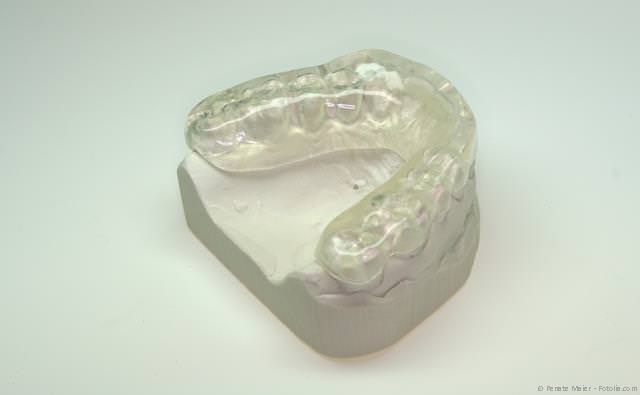 Schiene zur Stabilisierung der Bisslage Schiene zur Stabilisierung der Bisslage