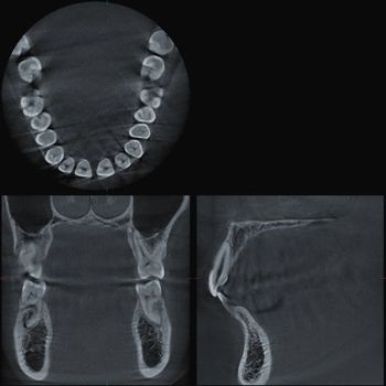 Röntgenaufnahmen der Zähne und Kiefer