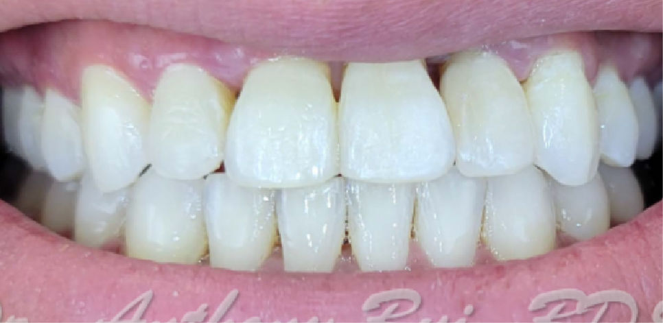 Ottawa Dental Care - Before and after
