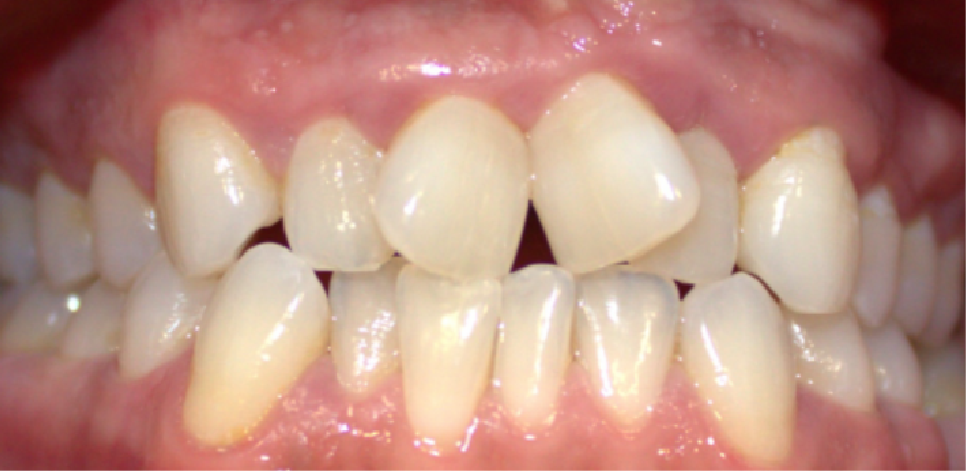 Ottawa Dental Care - Before and after