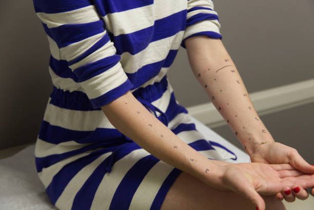 Allergy testing on a young woman.