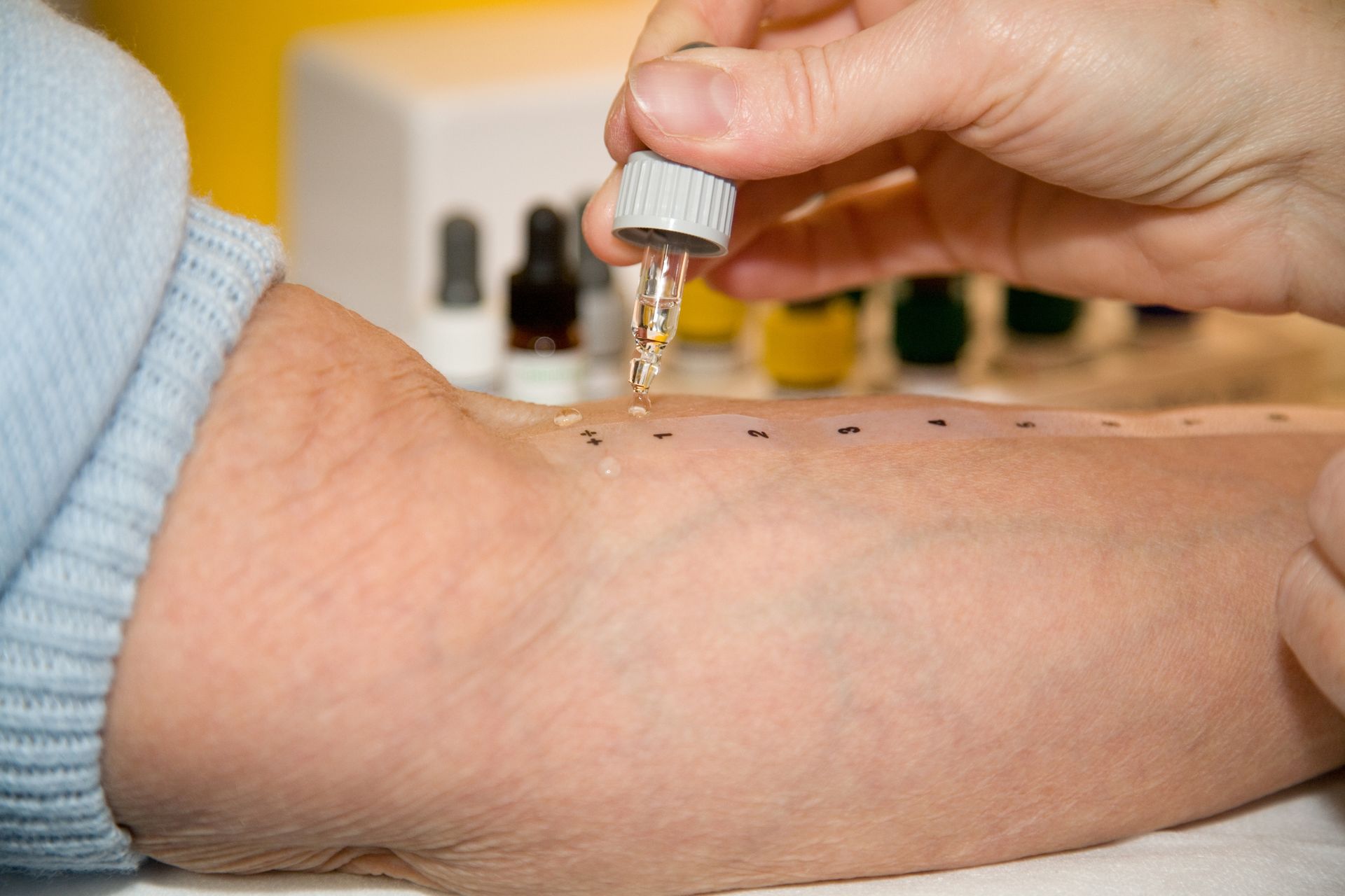 An older woman is getting an allergy skin test done at the Allergy and Asthma Clinic of Fort Worth in Irving, TX. An older woman is getting an allergy skin test done at the Allergy and Asthma Clinic of Fort Worth in Irving, TX.