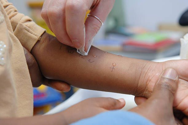 Child having an allergy test on her arm, prescribed by an allergy doctor.