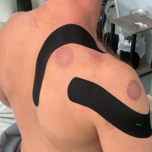 Soft Tissue Taping for the Upper and Lower Body