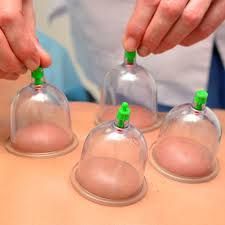Foundations of Cupping