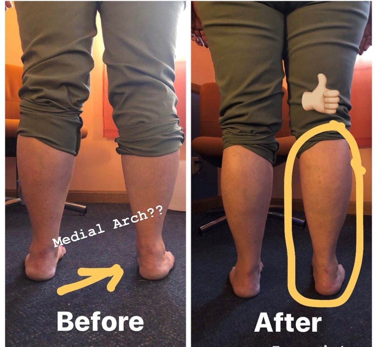 Structural Integration for the Pelvis, Hips, Low Back, and Lower Limbs