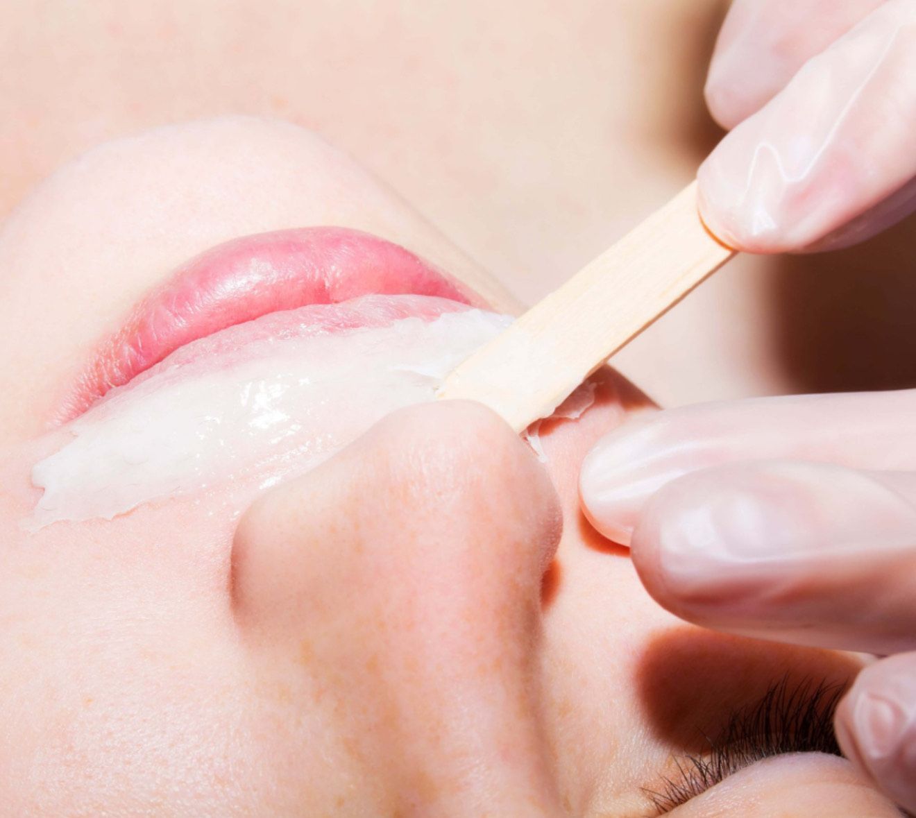 Waxing upper lip: A gloved hand applies wax to a person's face with a wooden spatula.