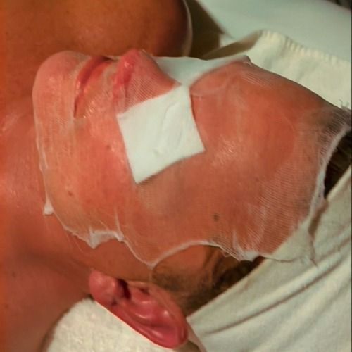 Man wearing a facial mask with gauze on his nose, lying down.