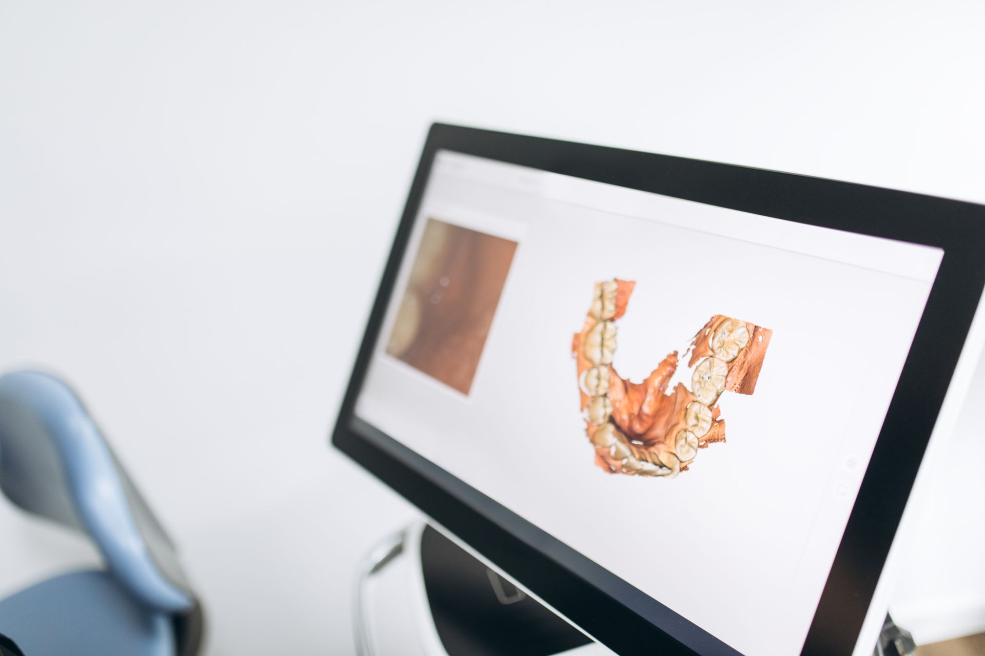 Mouth Image On Screen — QLD, AUS — Dental IT 365