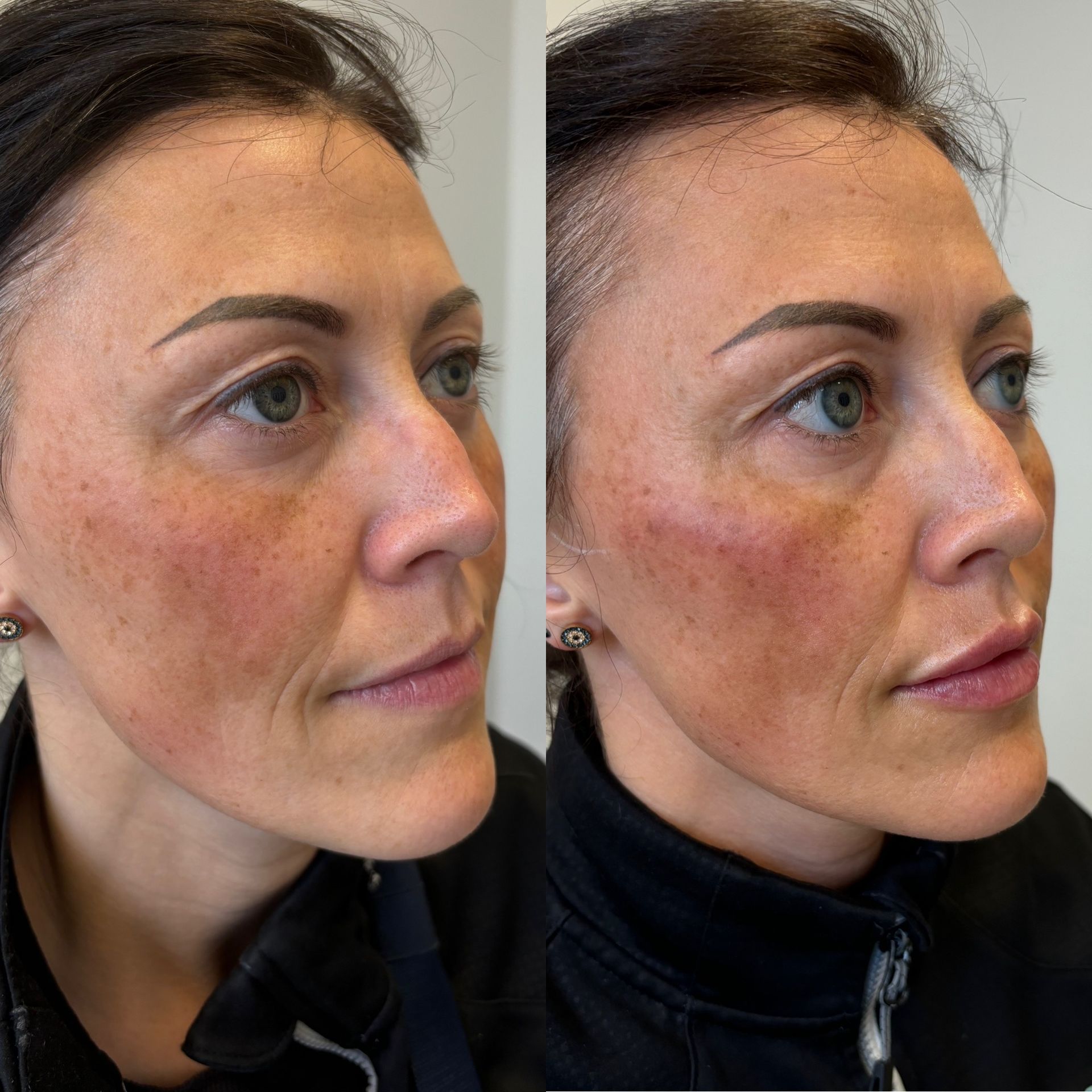 A before and after photo of a woman's face.