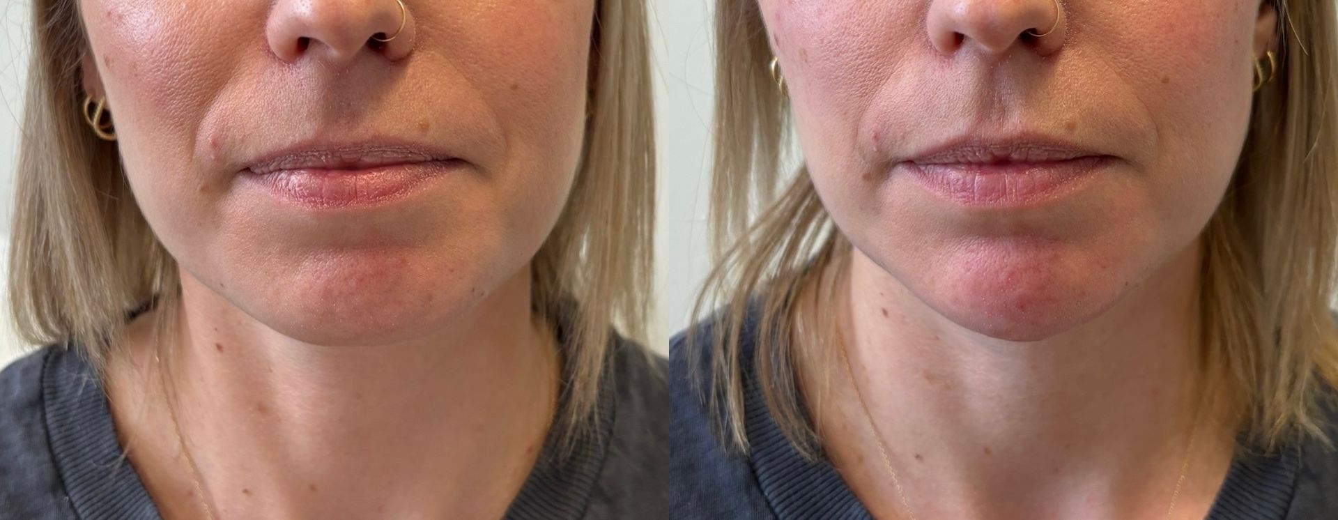 A before and after photo of a woman 's face.