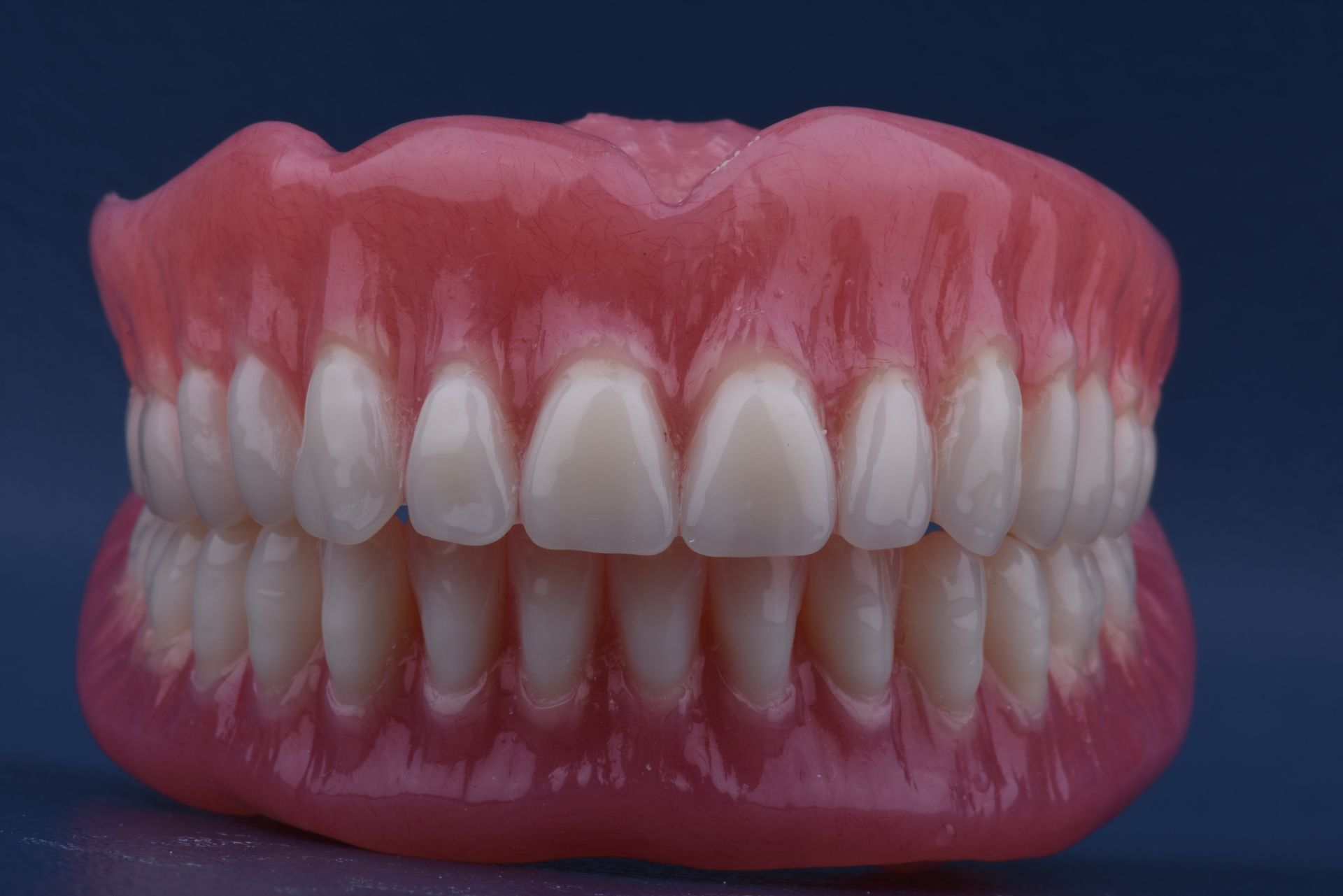 A Close Up of a Full Denture With White Teeth. — Goonellabah Denture Clinic in Stanthorpe, QLD