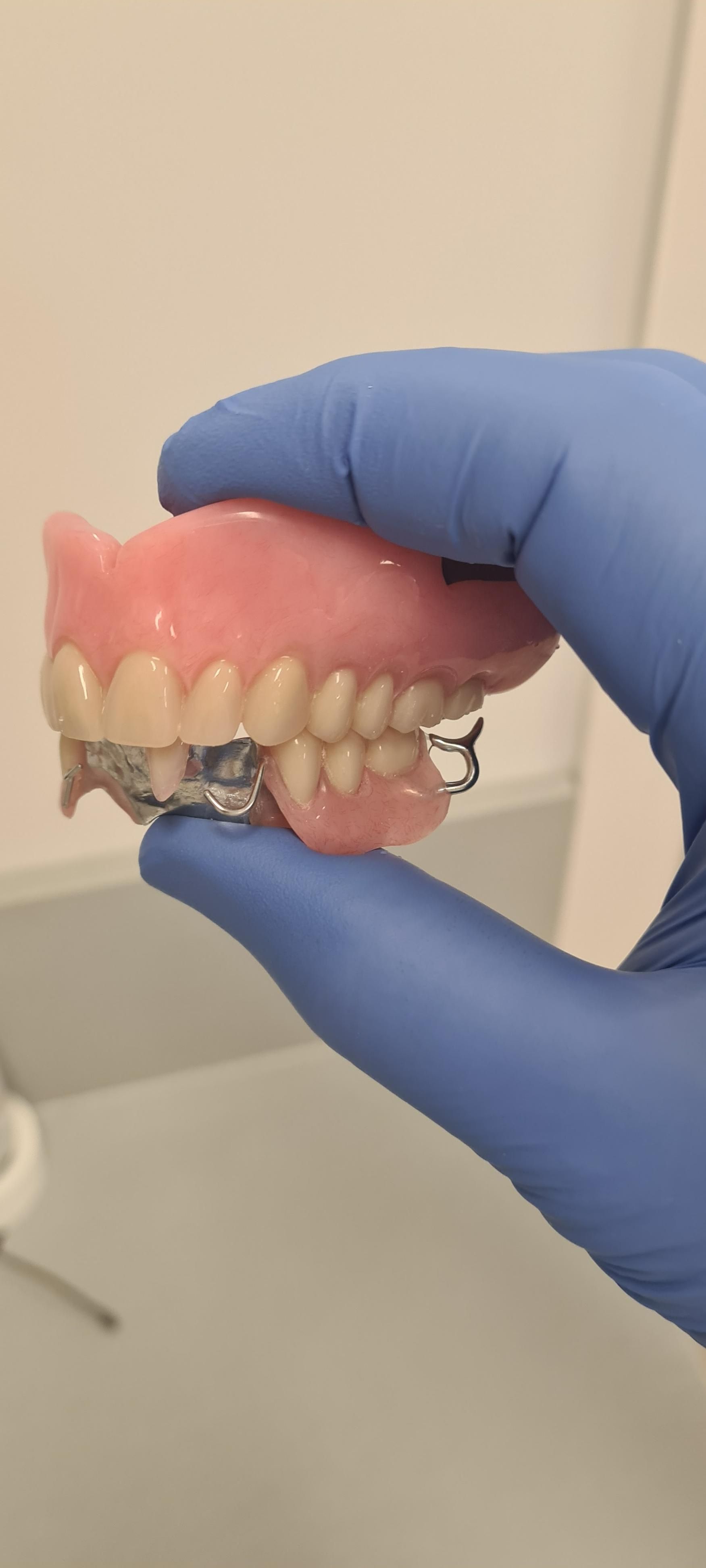 Dentist Showcasing Dental Implant-Supported Denture — Goonellabah Denture Clinic In Goonellabah, NSW