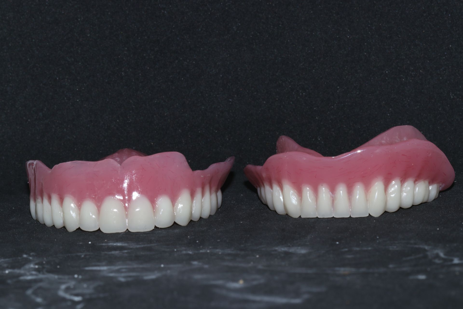 Two Dentures Are Sitting Next to Each Other on a Black Surface — Goonellabah Denture Clinic in Mullumbimby, NSW