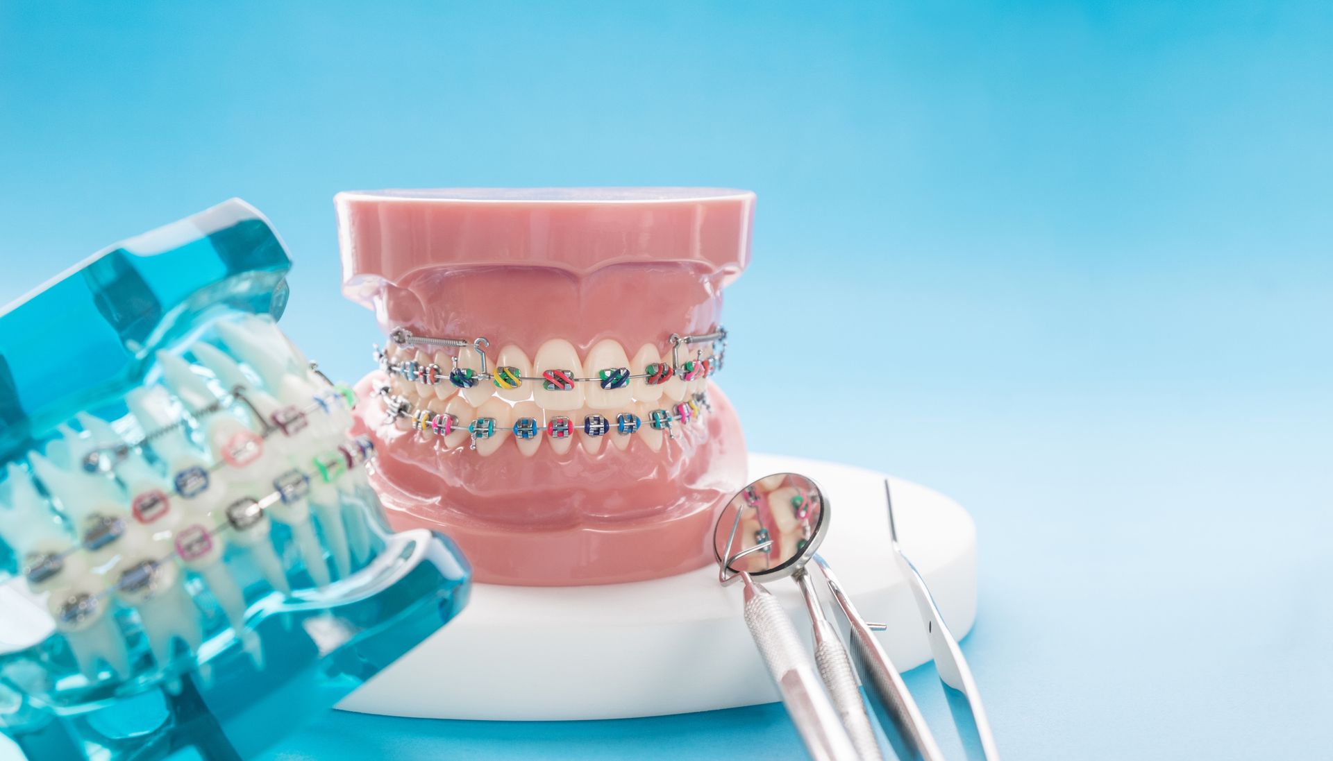 Close-up of dental model with braces, a clear model in front, with a blue background.
