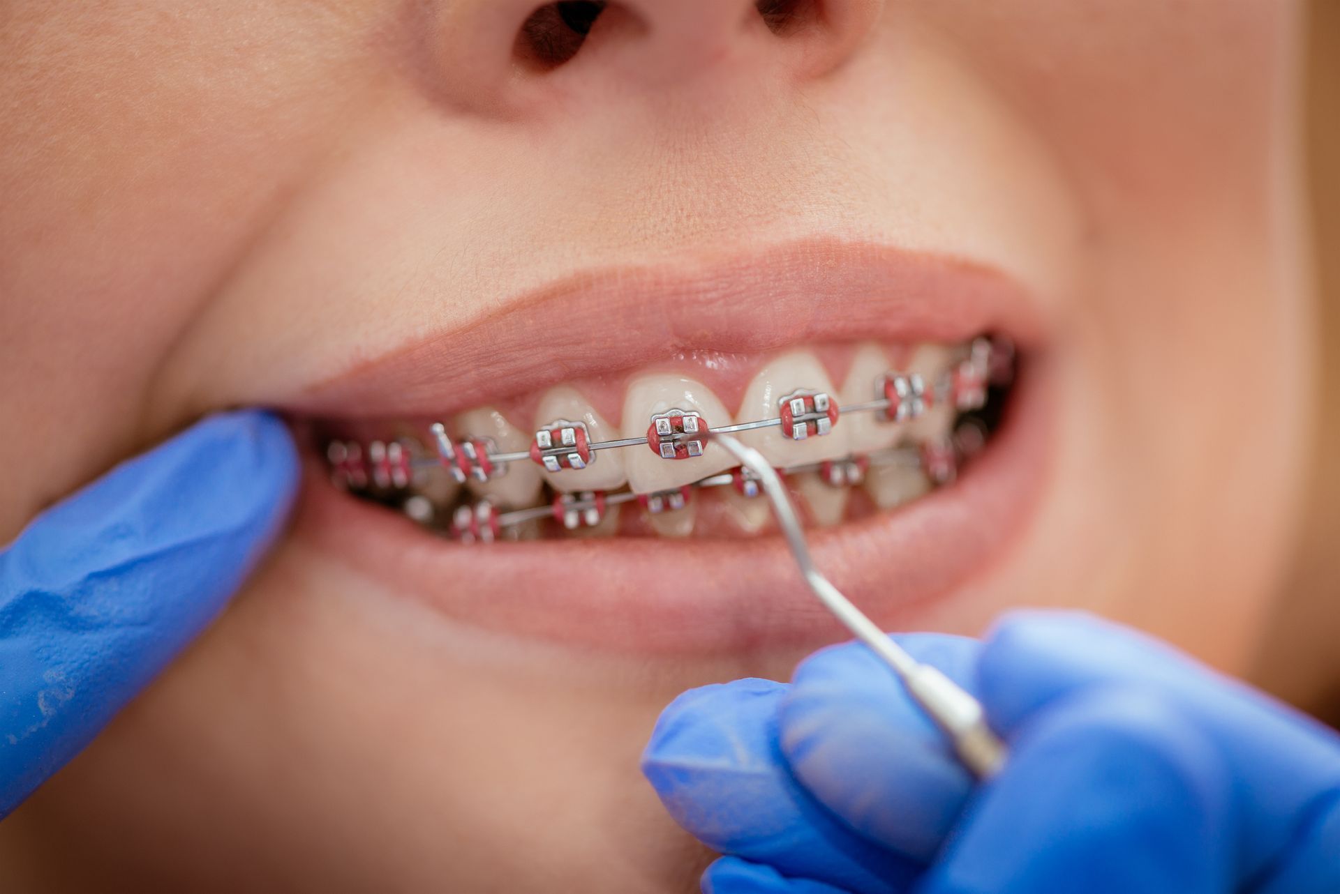 An orthodontist inspecting braces during a dental appointment.