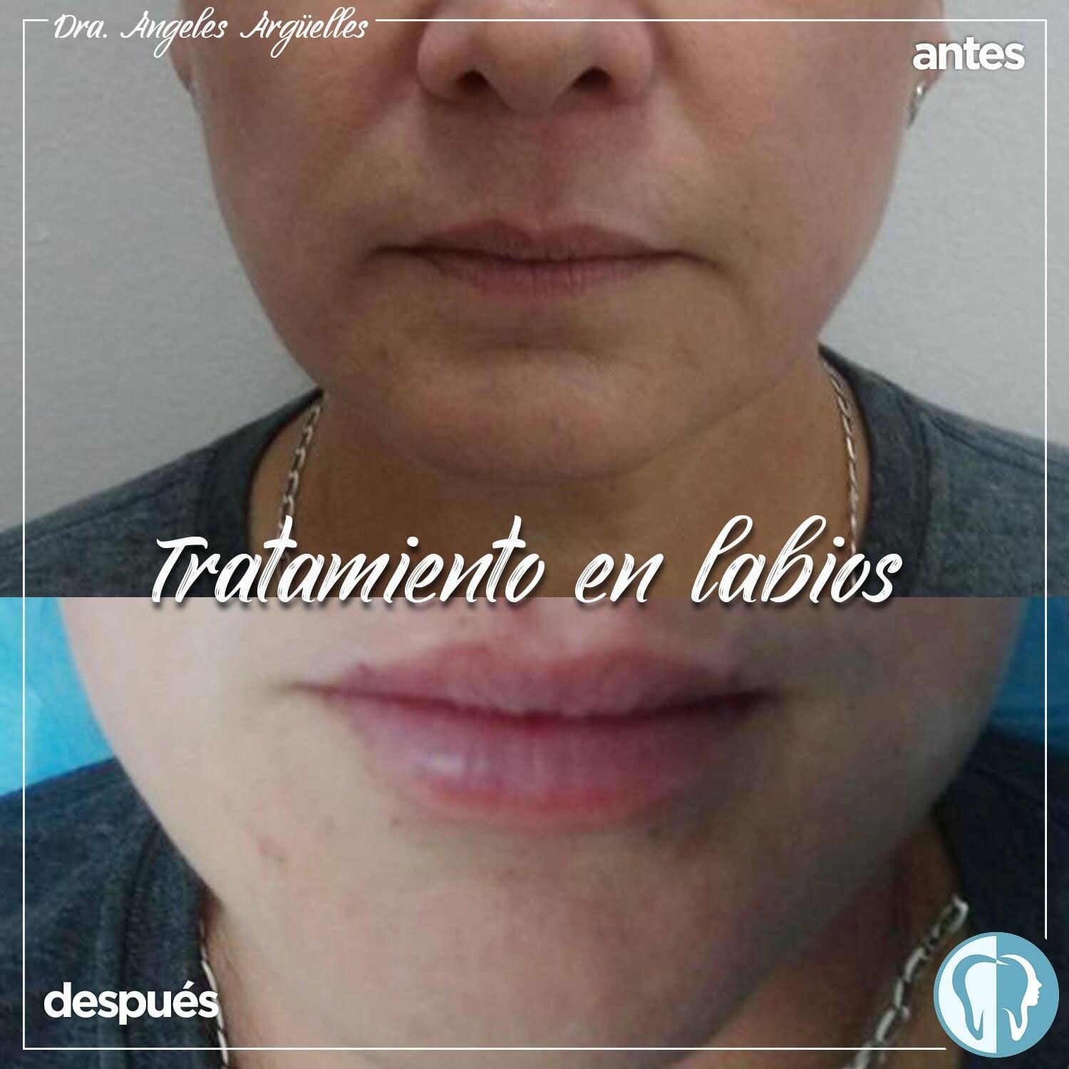 DRA. ÁNGELES ARGÜELLES MERCADO