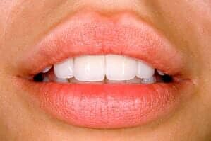 Beautiful smile - dental bridges in Pawtucket, RI / Beautiful smile - dental bridges in Pawtucket, RI