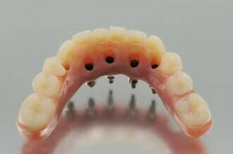 Some of our dental Implant Procedure Pawtucket, RI