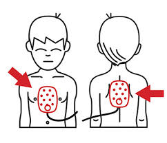 CPR BLS PROS AED rental