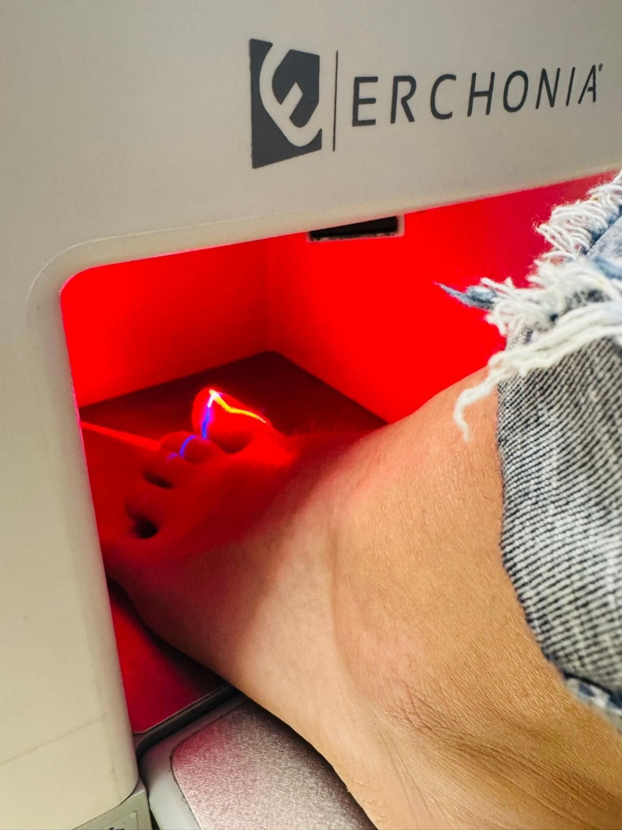 A Person's Foot Inside an Erchonia Red Light Therapy Machine — Alice Springs Podiatry in Ciccone, NT