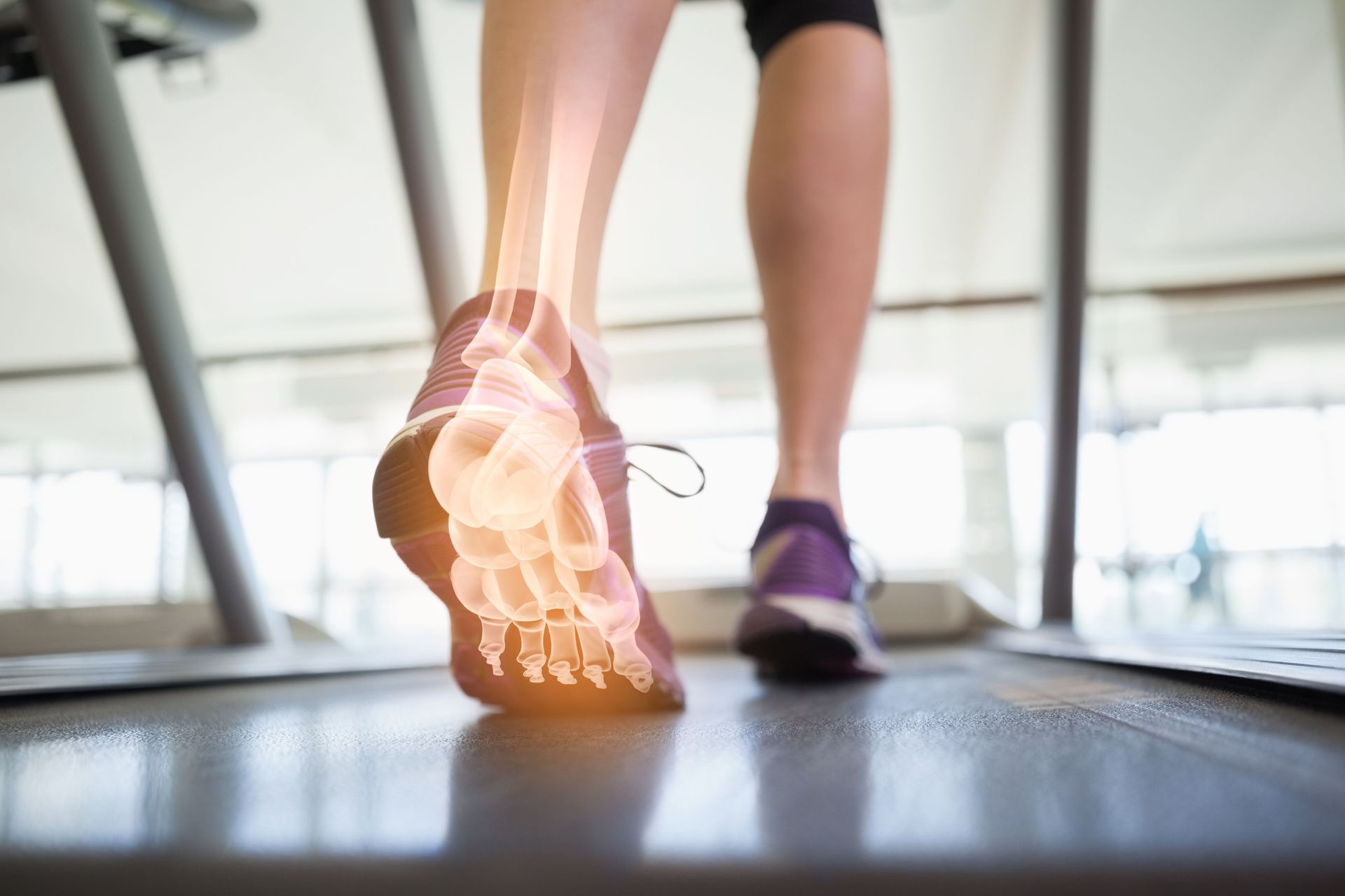 Person walking on treadmill, with highlighted foot bones visible.