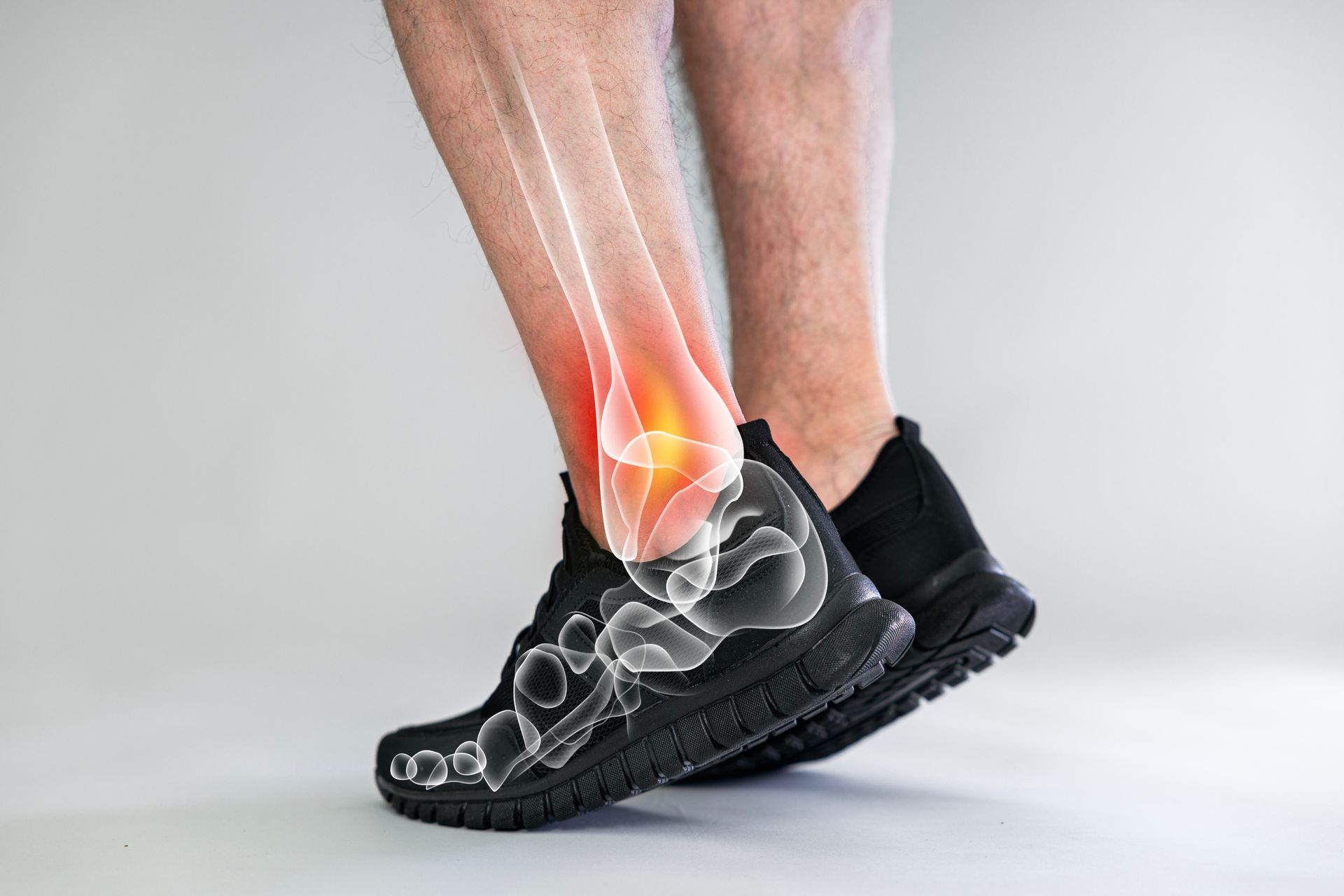 Person wearing black shoes, ankle injury highlighted in red with skeletal overlay.