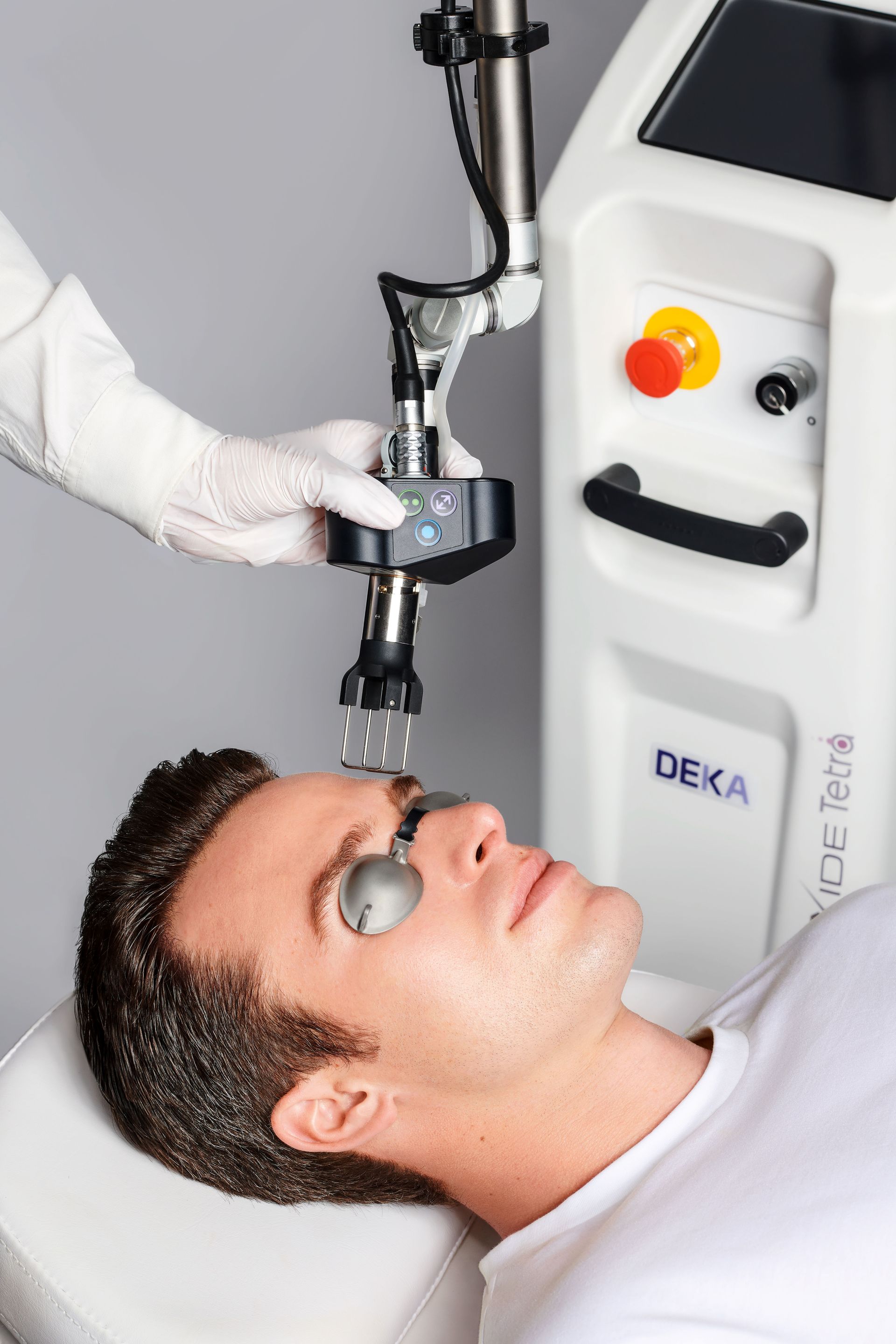 Man receiving laser skin treatment with goggles on. A gloved hand manipulates the laser device. DEKA device in background.