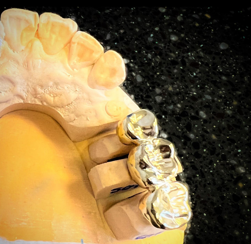 dentist in thornton co