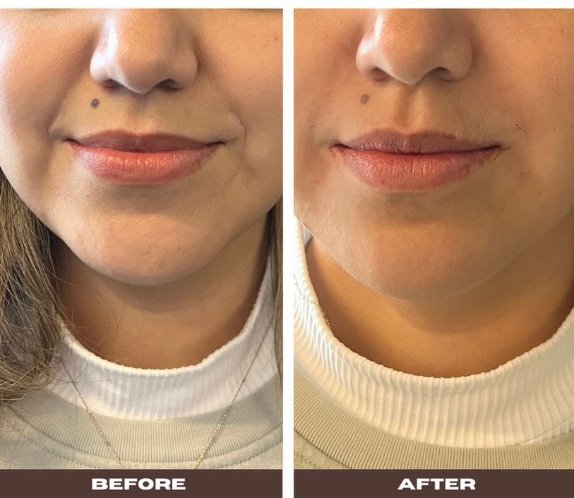 dentist in thornton co