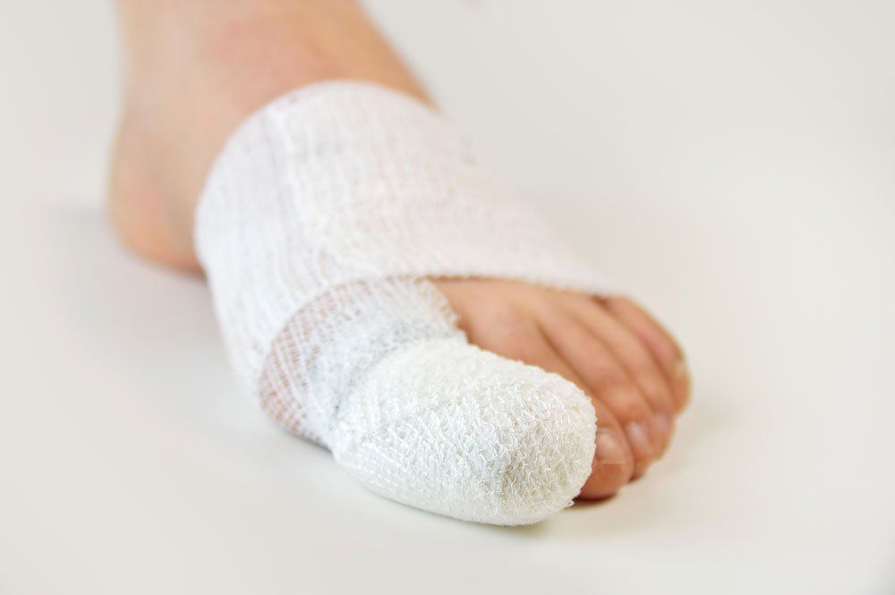 Foot After Surgery — Indianapolis, IN — Northeast Foot And Ankle