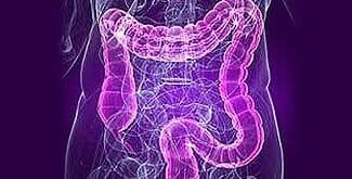 DR. EDUARDO PERALES SALAZAR - colitis