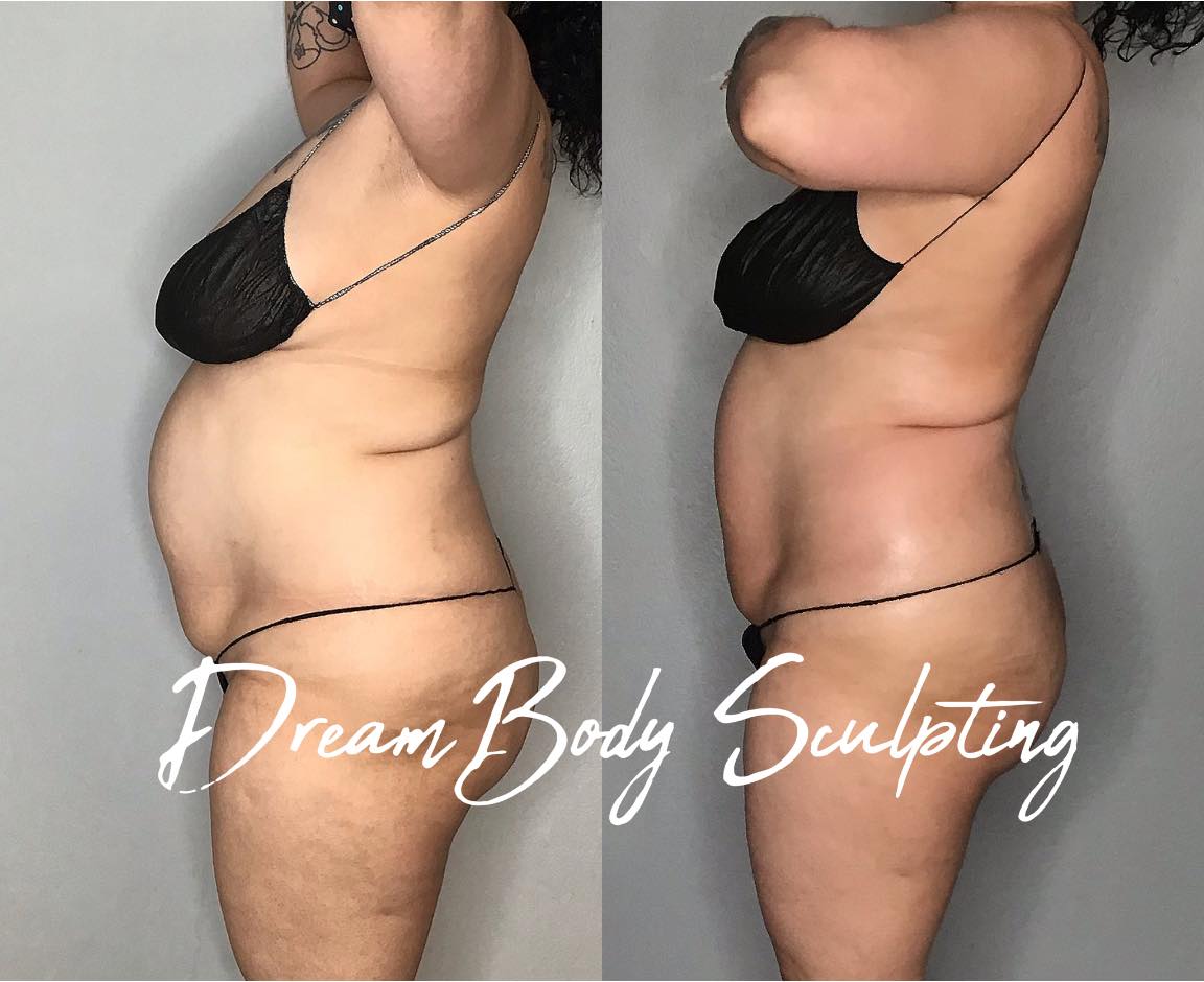 body contour photo