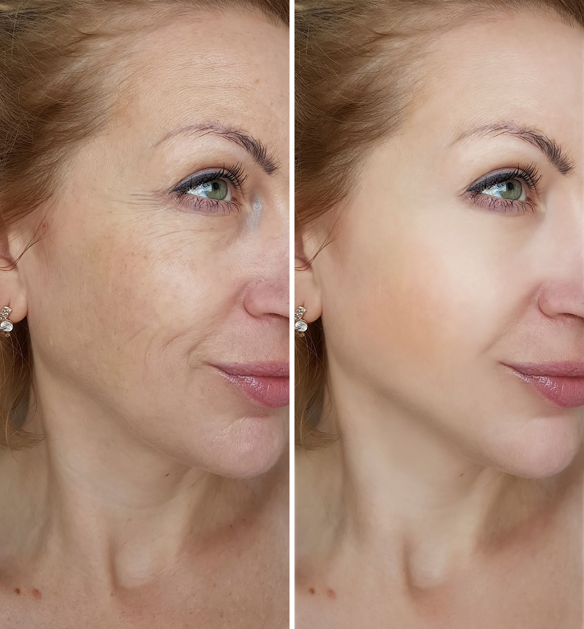 A before and after photo of a woman 's face.