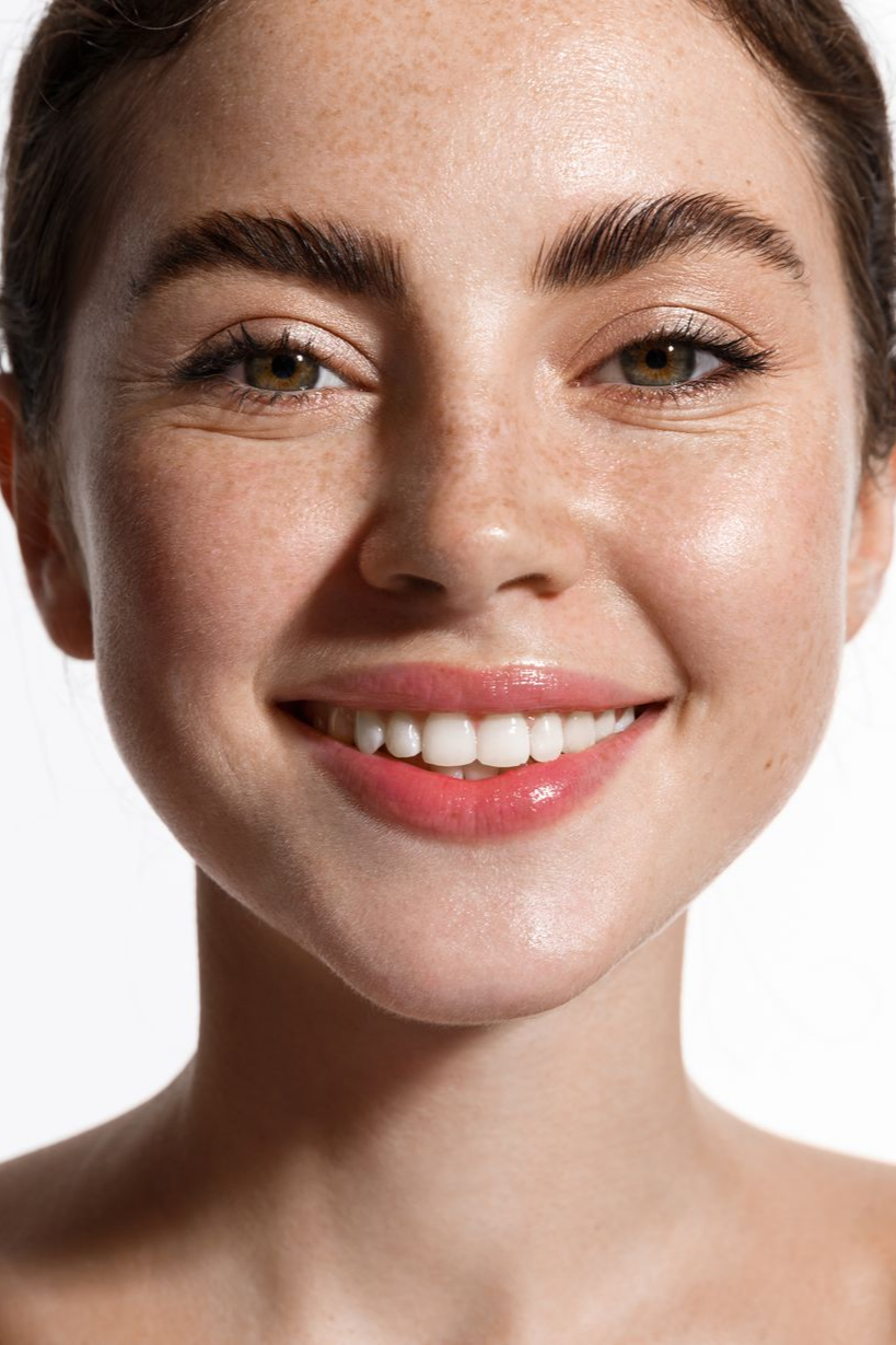 Woman smiling, freckles, glossy lips, natural makeup, radiant skin.