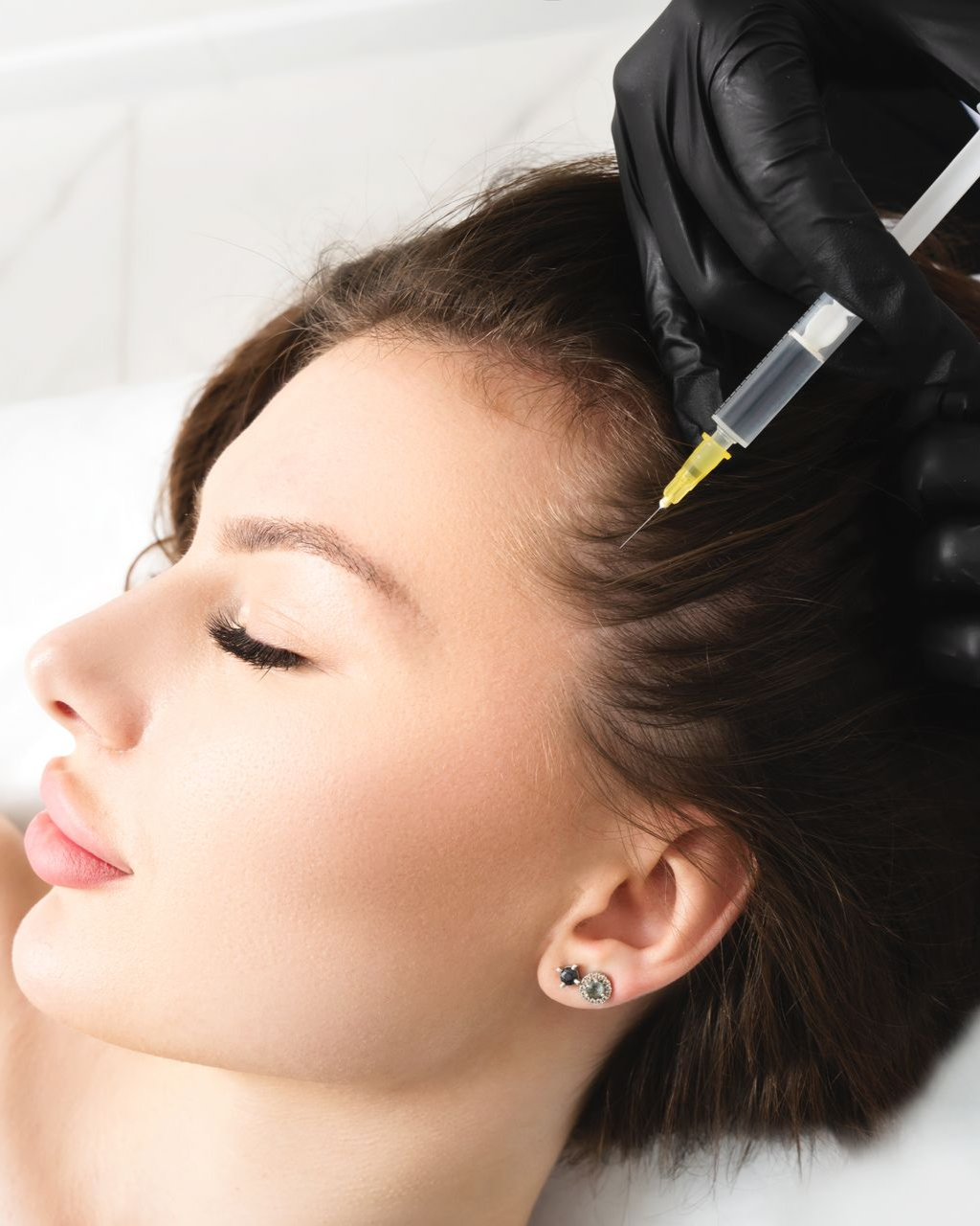 Person receiving hair injection on scalp, syringe held by gloved hand.