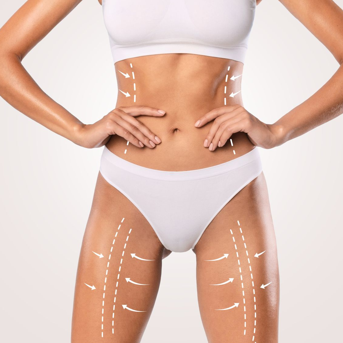 Body with white arrows showing areas for cosmetic procedures.