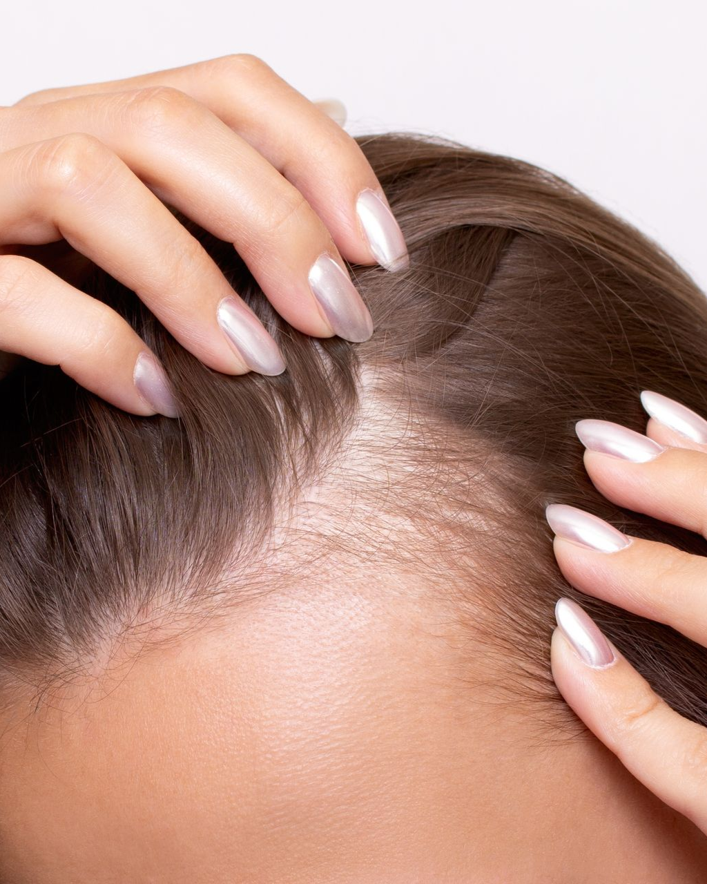 Person's hand gently touching their hairline, revealing sparse hair and scalp.
