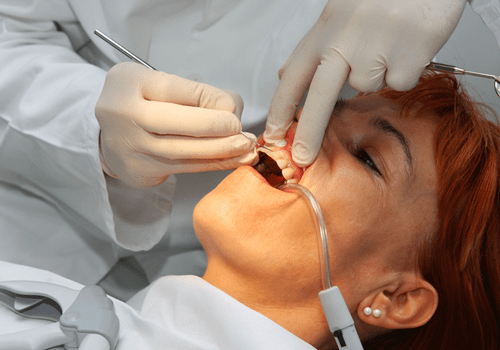 Dentist at work - Periodontics in Hemet, CA
